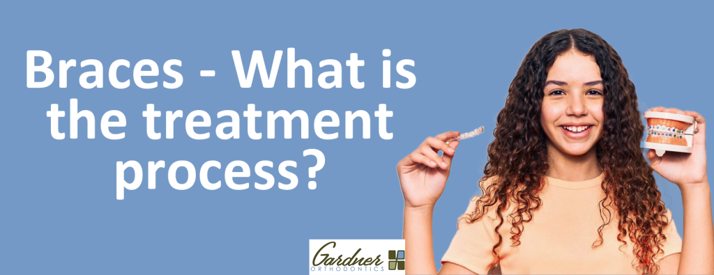 Braces process - Gardner Orthodontics - Best orthodontist in Pahrump