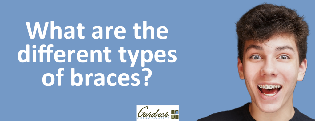 What are different types of braces_ - Gardner Orthodontics - Best orthodontist in Pahrump