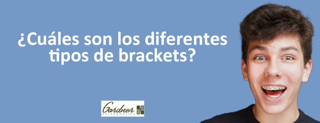 ¿Cuáles son los diferentes tipos de brackets? - Gardner Orthodontics - Best orthodontist in Pahrump